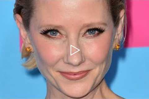 Anne Heche Suffers Severe Injuries In Fiery Car Crash