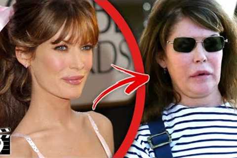 Top 10 Celebrities Who Destroyed Their Careers With Plastic Surgery